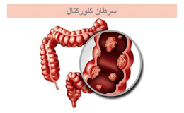 اجرای طرح مطالعه تأثیر متامفتامین بر ژن&zwnj;های دخیل در سرطان کلورکتال